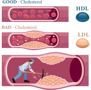 Understanding Lipids